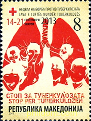 TUBERCULOSIS